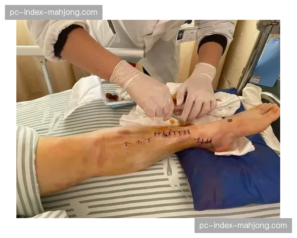 科利尔三月接受左脚踝手术，此前一月已进行右脚踝手术